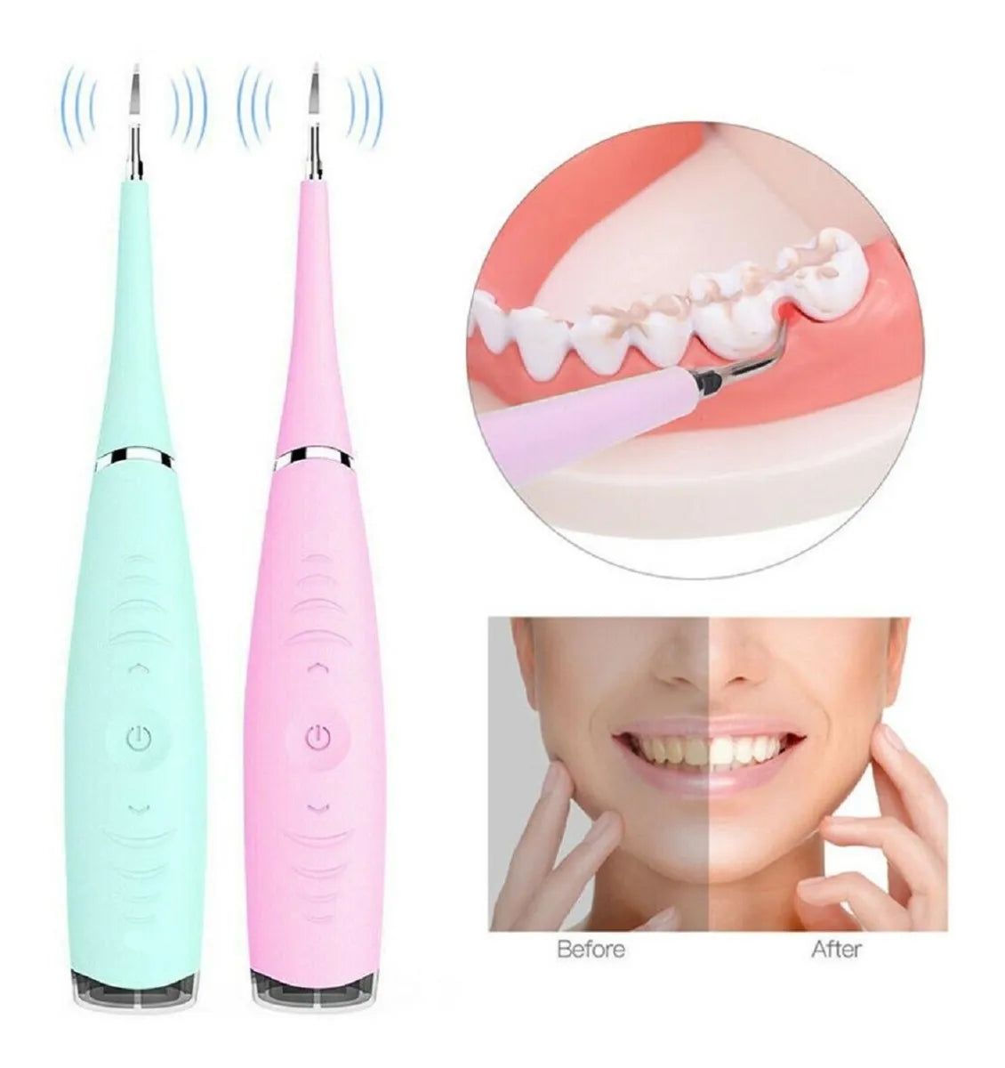 Dental Ultrasonico Removedor Dental Calculos Portatil Usb