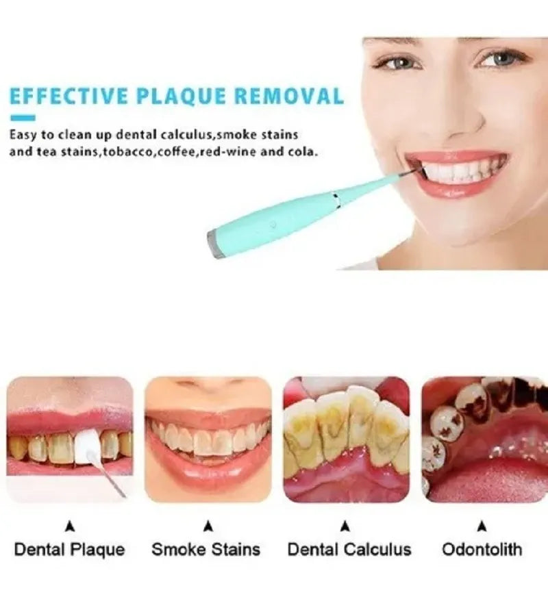 Dental Ultrasonico Removedor Dental Calculos Portatil Usb