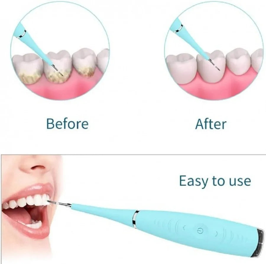 Dental Ultrasonico Removedor Dental Calculos Portatil Usb